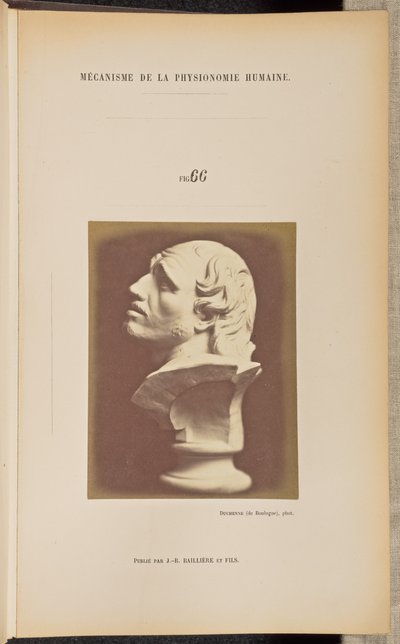 Fig. 66 door Guillaume Benjamin Duchenne