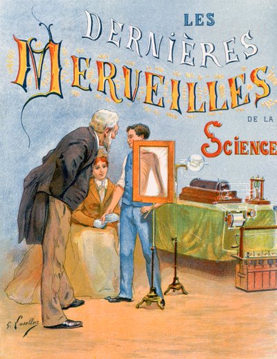 Het onderzoek van een kinderarm door radiografie door Gustave Francois Lasellaz