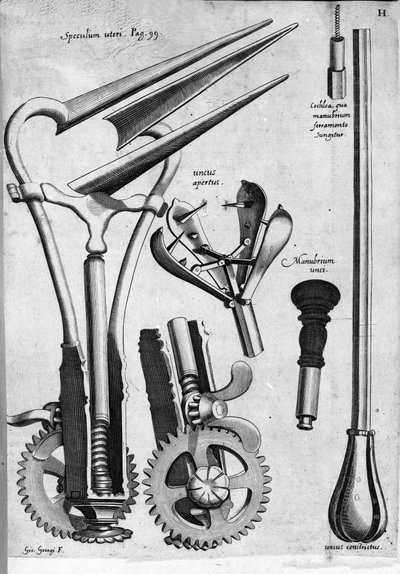 Gynaecologie: Plaat met een speculum. Gravure door Girolamo Fabricii in 