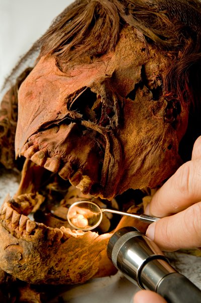 Dr. John Varano van Tulane University onderzoekt de tanden van de mummie. door Ira Block