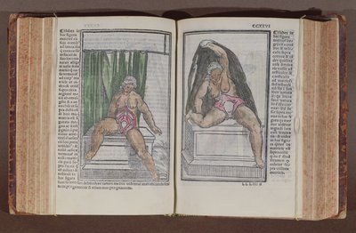 Vrouwelijke anatomie, uit Commentaria cum amplissimis additionibus super anatomiam mundini, door Jacopo Berengario da Carpi (c.1460-c.1530) gepubliceerd in Bologna, 1521 (kleur houtsnede) door Italian School