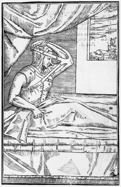Reconstructieve neusoperatie, illustratie uit De curtorum chirurgia per insitionem door Gaspare Tagliacozzi (1545-99) Venetië, gepubliceerd 1597 door Italian School