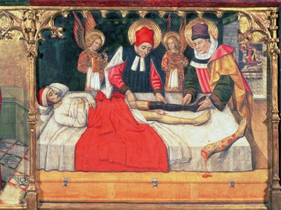 SS. Cosmas en Damian transplanteren het been van een Ethiopische man op de stomp van diaken Justinianus door Jaume Huguet