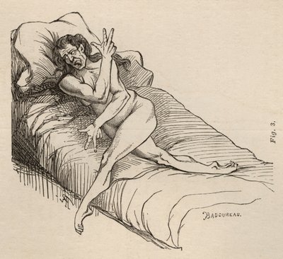 Hysterische epilepsie, aanval, vervormingen, fig. 3 uit 