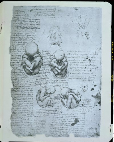 Vijf Zichten van een Foetus in de Baarmoeder, facsimile kopie door Leonardo da Vinci