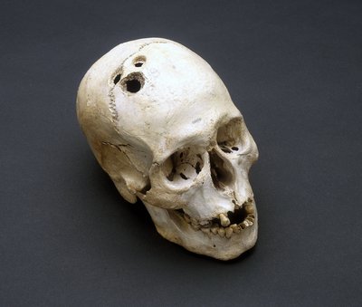 Trepanatie Bronstijd schedel, Jericho, Palestina, 2200-2000 v.Chr. door Unbekannt Unbekannt