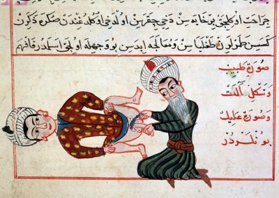 Geneeskunde: castratie van een hermafrodiet. Miniatuur uit een verhandeling over Turkse geneeskunde door Sharaf al-din door Ottoman School
