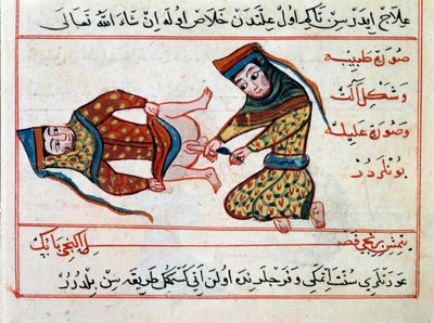 Medische operatie van een hermafrodiet door Ottoman School