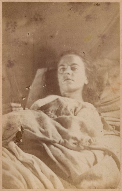 Hysterische epilepsie, aanval, derde periode, plaat XXVI uit 