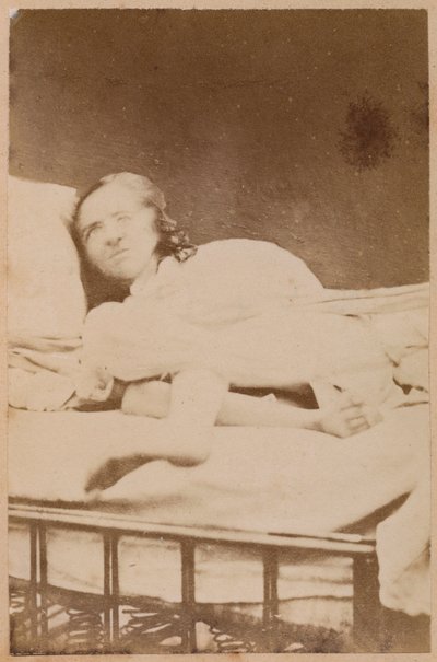 Hysterische epilepsie, vervormingen, plaat XXXVIII uit 