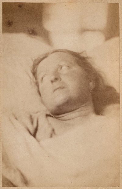 Hysterische epilepsie, kruisiging, hoofdhouding, plaat VII uit 