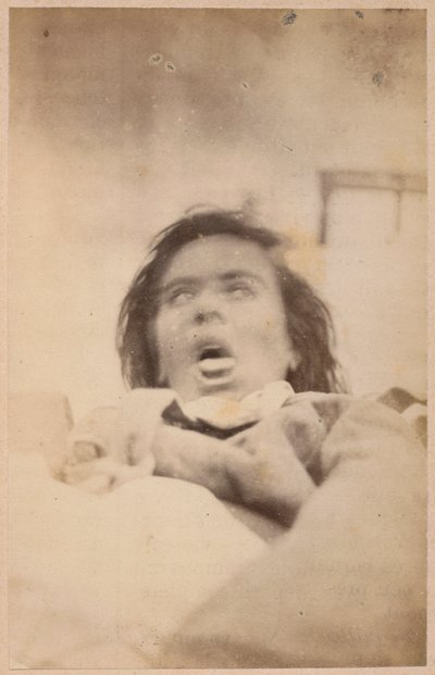 Hysterische epilepsie, hallucinaties, angst, plaat XXIX uit 