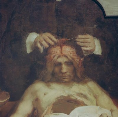 De anatomie van Dr. Johan Deijman door Rembrandt van Rijn