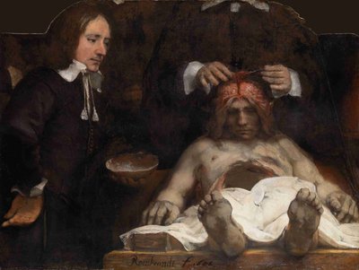 De Anatomische Les van Dr. Jan Deijman door Rembrandt van Rijn