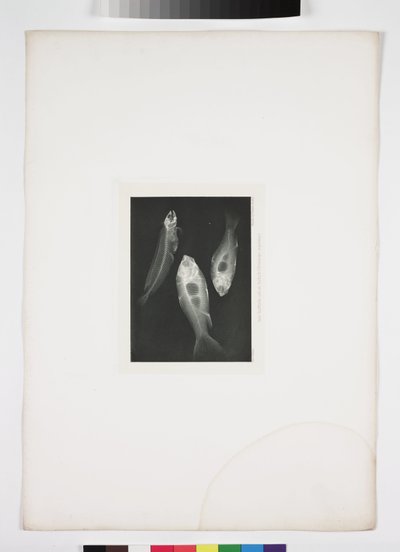 Diagnostische radiologie, röntgenfoto