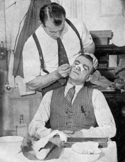 Engeland aanvoerder Eddie Hapgood krijgt behandeling voor een gebroken neus na een wedstrijd met Italië, 1934 door Topical Press Agency
