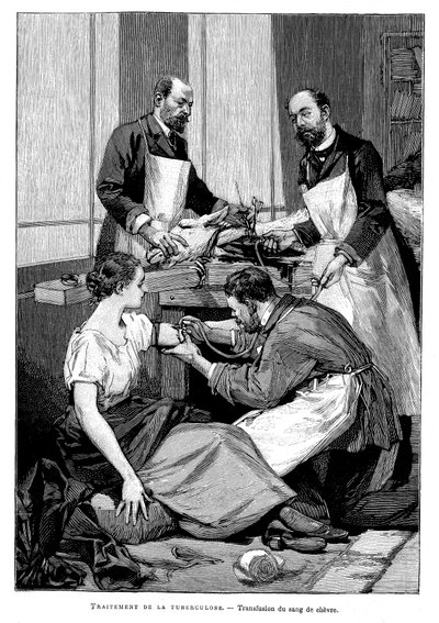 Een tuberculosepatiënt krijgt een transfusie van geitenbloed, 1891 door Unbekannt