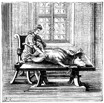 Dier-tot-mens bloedtransfusie, 1679 door Unbekannt