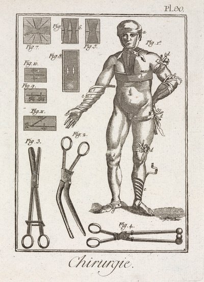 Apparatuur, vroegmoderne verbanden van een menselijk figuur door Unbekannt