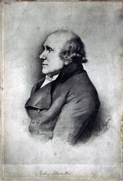 John Hunter, Britse chirurg en anatoom, ca. 1770s door Unbekannt