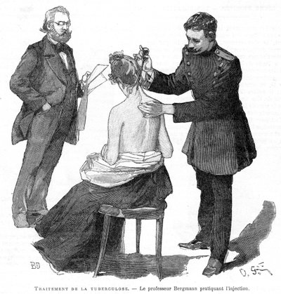 Professor Bergmann injecteert een tuberculosepatiënt, 1891 door Unbekannt
