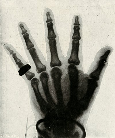 Röntgenfoto van de hand van Z.K.H. De Prins van Wales, c1897 door Unbekannt