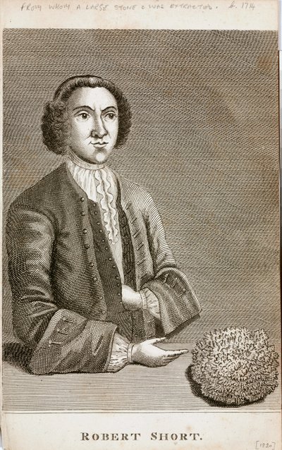Robert Short, medische curiositeit, ca. 1750s door Unbekannt