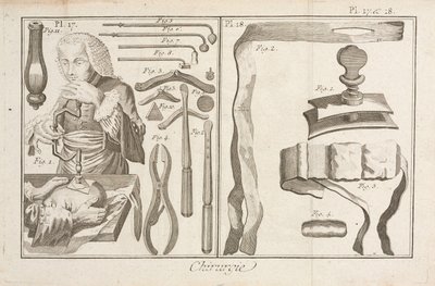 Trepanatie door Unbekannt