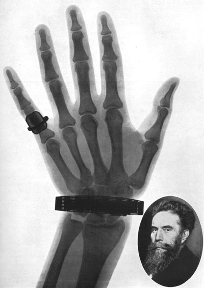 Röntgenfoto van een hand, 1926 door Unbekannt