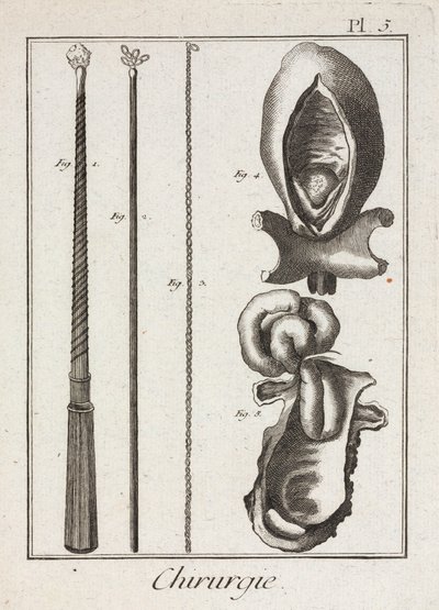 Uitrusting, vroegmoderne chirurgische instrumenten en diagrammen van lichaamsdelen door Unbekannt