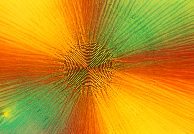Micrografie (Licht) Ascorbinezuur, licht micrografie door Unbekannt
