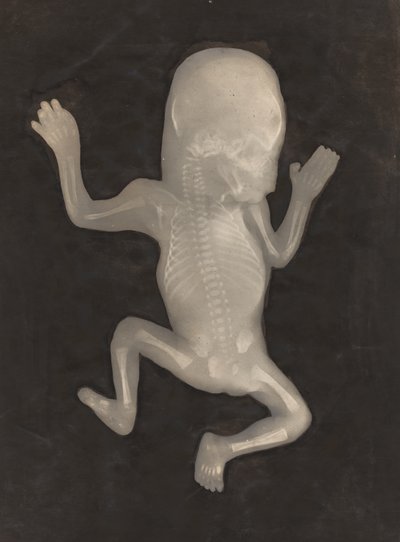 Ossificatiegraad van een vijf maanden oude foetus door Unknown