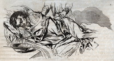 Ongevalgeneeskunde - over de meest effectieve hulp aan drenkelingen - de walnootluiers aan de zijkant en het braken van het water dat hij dronk - gravure in 