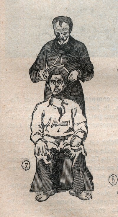 De gerechtelijke antropometrie of bertillonage, methode van Alphonse Bertillon (1853-1914): meting van de transversale diameter van de schedel - Gravure in 