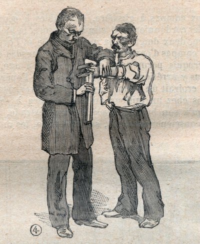 De gerechtelijke antropometrie of bertillonnage, methode van Alphonse Bertillon (1853-1914): meting van de middelvinger en de ringvinger van de linkerhand - Gravure in 