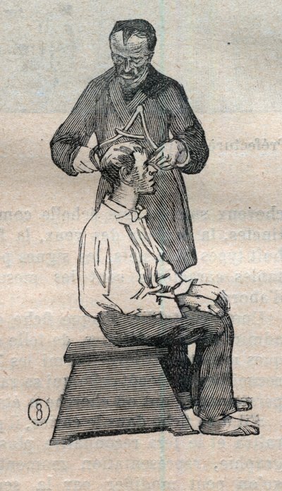 De gerechtelijke antropometrie of bertillonnage, methode van Alphonse Bertillon: meting van de dwarse diameter van de schedel - Gravure in 