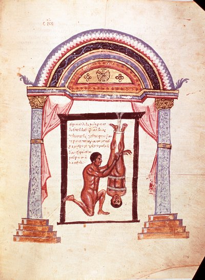 Geneeskunde: reductie van een ontwrichte knie, de patiënt hangt ondersteboven (manuscript) door Unknown artist