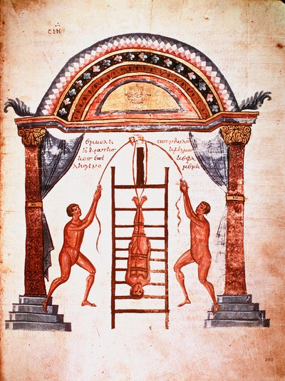 Geneeskunde: reductie van een ontwrichte wervelkolom, patiënt wordt opgehangen met riemen aan een ladder (manuscript) door Unknown artist