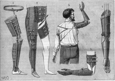 Moderne apparaten voor geamputeerden. 1) kunstbeen met riem, 2) apparaat voor het ontwrichten van de dij, 3 en 4 kunstarmen uitgevonden en gebouwd door M.L Matthieu voor de overleden Roger, 5) kunstarm met hand, duim en wijsvinger. in "La nature" van 1888 door Unknown artist