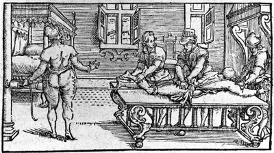Reductie van een ontwrichting, in "Traité Médical" door Ambroise Paré, circa 1560 door Unknown artist