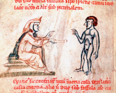 De dokter brandt de patiënt op pijnlijke plekken met hete ijzers, miniatuur uit het manuscript 
