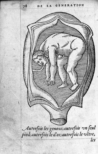 De positie van de foetus in de baarmoeder tijdens de zwangerschap. Gravure uit 