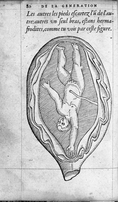 De positie van de foetus in de baarmoeder tijdens de zwangerschap. Gravure uit 