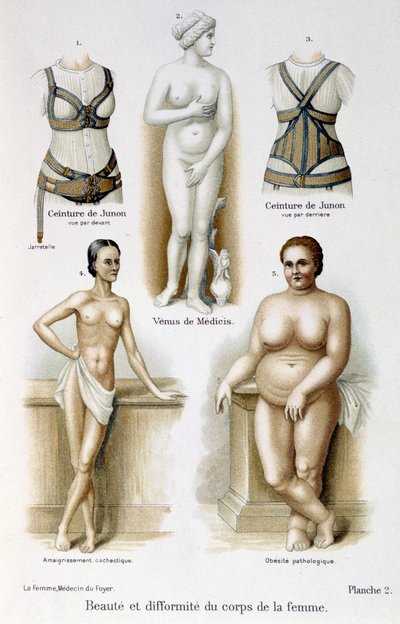 Schoonheid en misvorming van het vrouwenlichaam (mager en obesitas); Juno