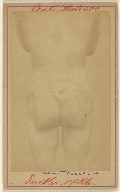 [Jno. E. Tucker, in de billen geschoten, slachtoffer burgeroorlog]. door Unknown artist