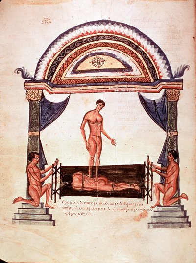 Geneeskunde: reductie van een ontwrichte wervelkolom - patiënt is vastgemaakt op een houten plank, een van de therapeuten staat op zijn rug (manuscript) door Unknown artist