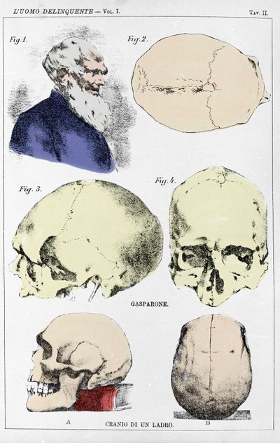 Studie over de morfologie van een misdadigersschedel door de Italiaanse criminoloog door Unknown artist