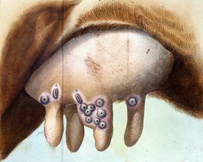 De uier van de koe gebruikt om het pokkenvaccin in te enten door Luigi Sacco (1769-1836) in januari 1801. Medische plaat uit 