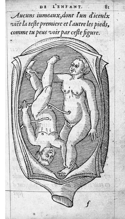 De positie van de foetus in de baarmoeder tijdens de zwangerschap. Gravure uit 