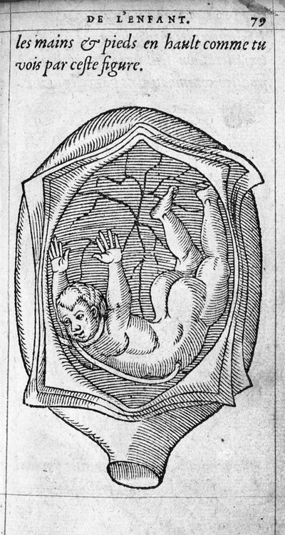 De positie van de foetus in de baarmoeder tijdens de zwangerschap. Gravure uit 